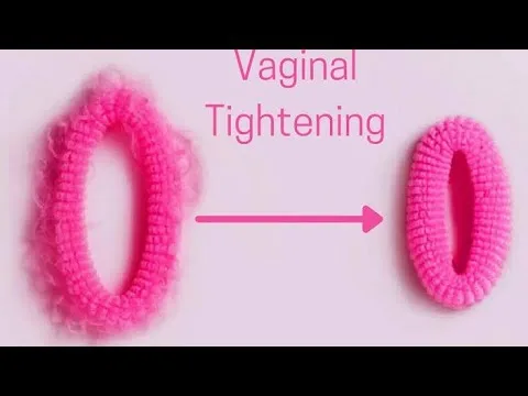 How Vaginal Tightening Can Support Women’s Confidence and Comfort