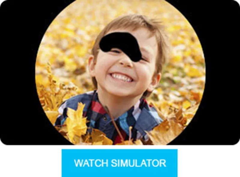 Primary Open-Angle Glaucoma (POAG)