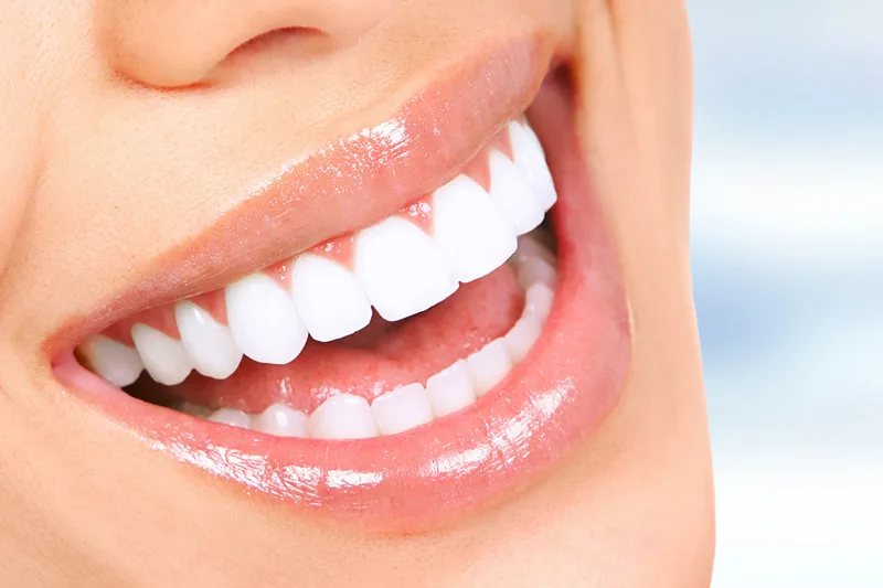 5 Tips for Selecting the Right General Dentist in Fairfax, VA