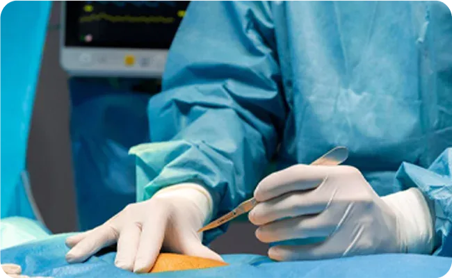 Microvascular Surgery and Pain: Separating Common Myths From Facts