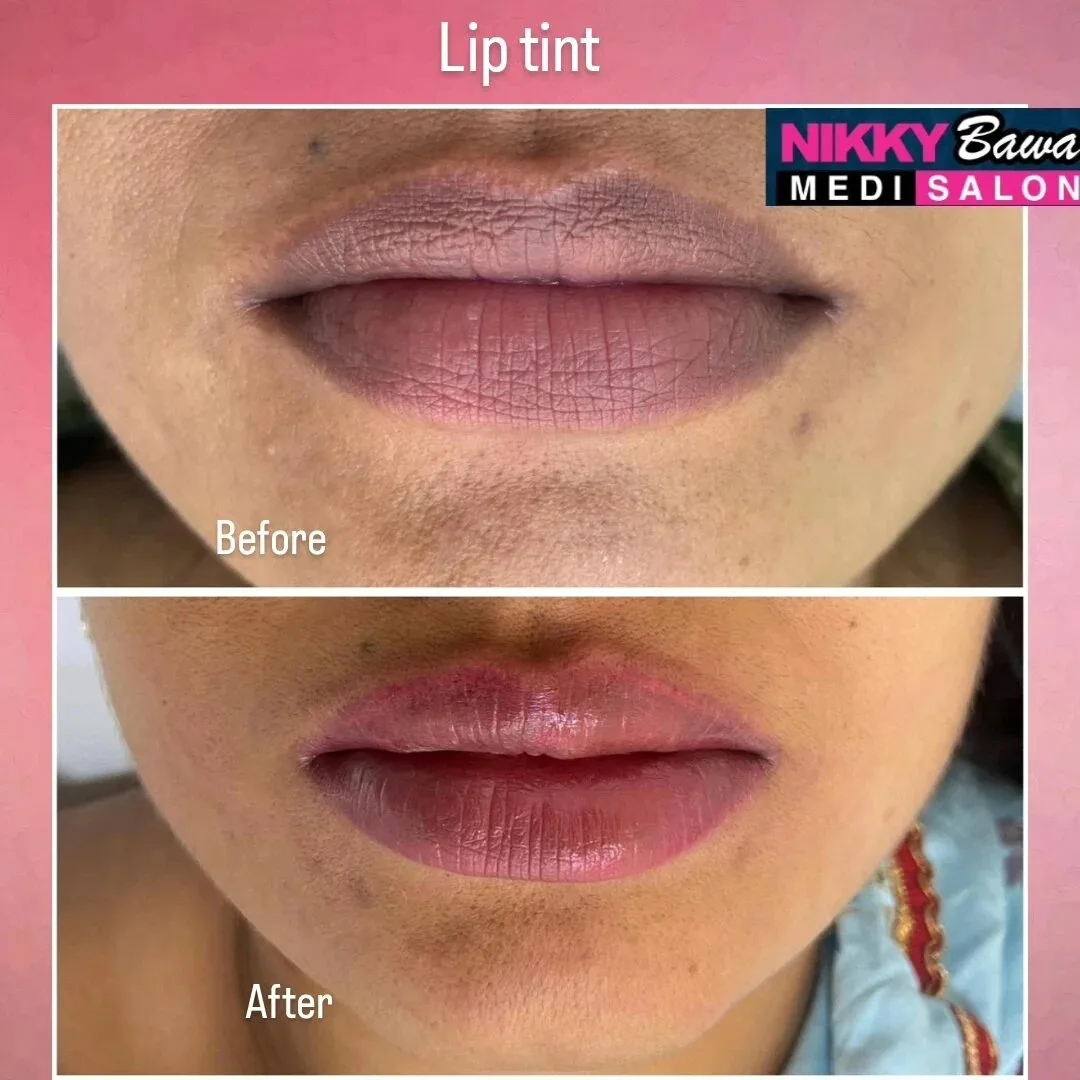 Permanent Lip Tint Benefits: Why Aesthetic Salon Professionals Recommend It
