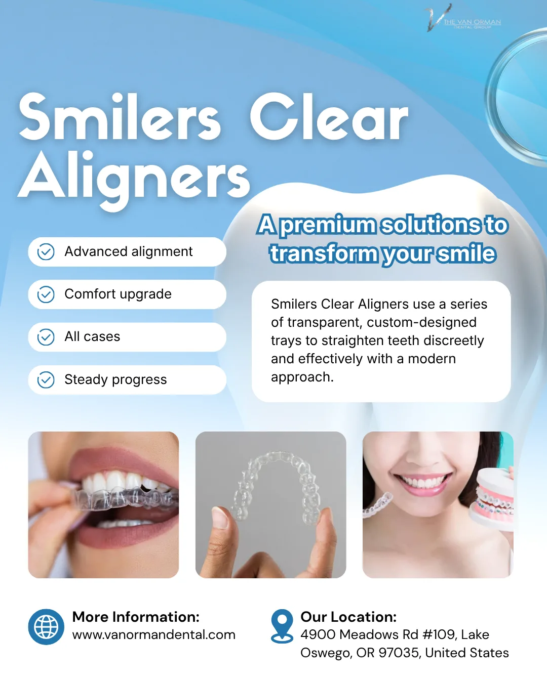 How Long Do Smilers Clear Aligners Take to Straighten Teeth?