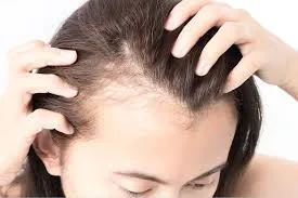 A Practical Guide to Managing Hair Loss with Everyday Solutions