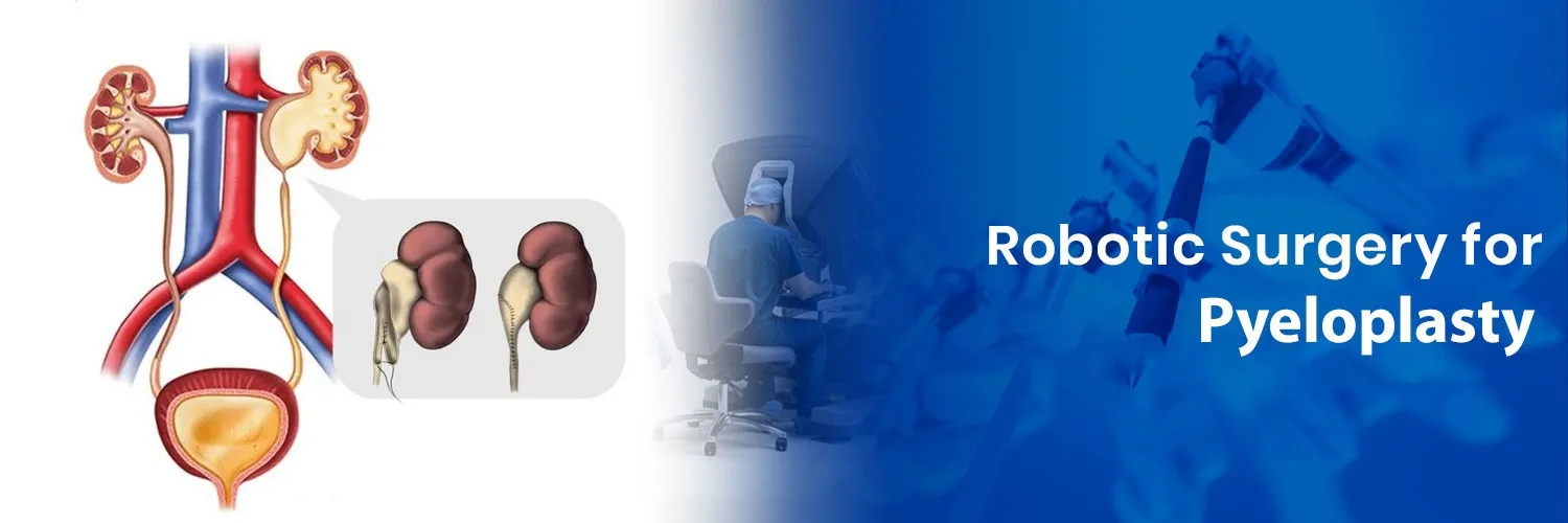 Robotic Pyeloplasty Surgery in Delhi: Advanced Care for Pediatric UPJ Obstruction