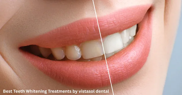Best Teeth Whitening Treatments by Cosmetic Dentists