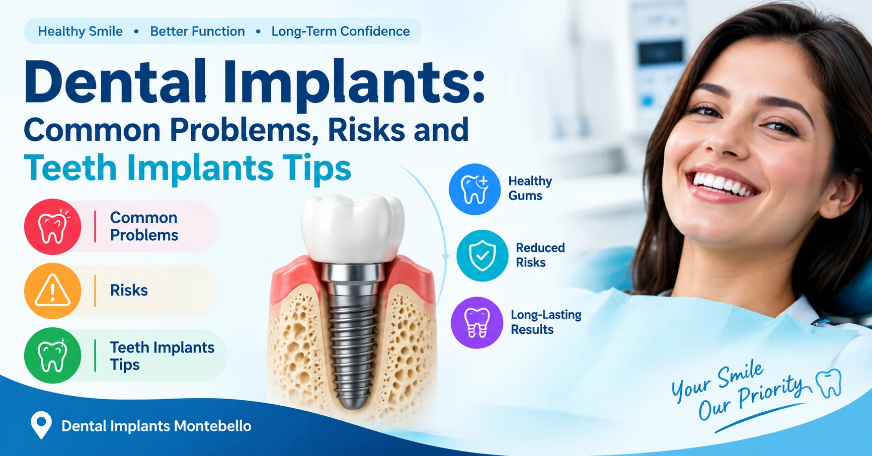 Dental Implants: Common Problems, Risks and teeth implants Tips