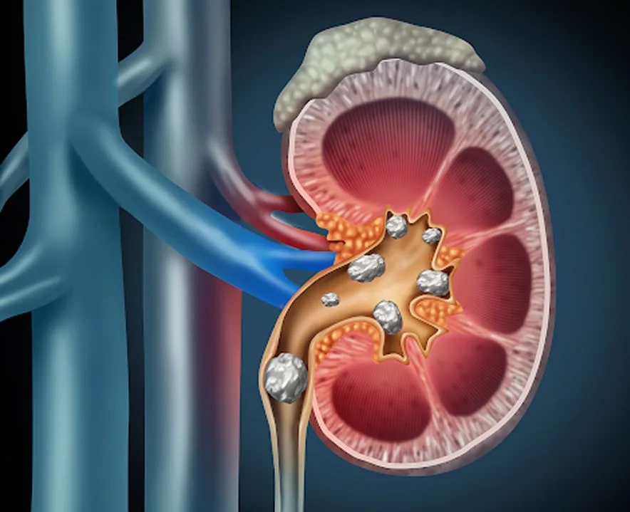 How to Find the Best Physician  Urologist and Pediatrician?