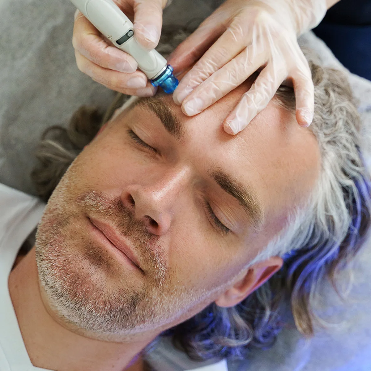 Laser Treatments vs Traditional Grooming Methods: Why Men Are Exploring Long-Term Solutions in Tysons