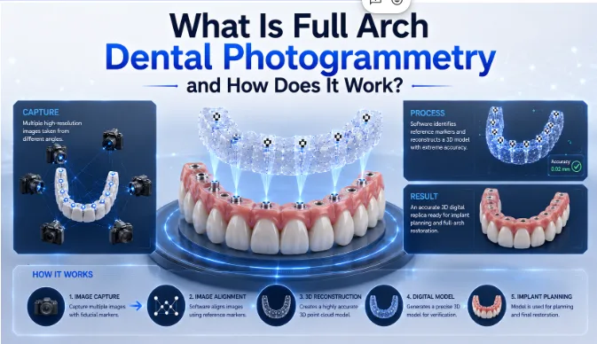 What Is Full Arch Dental Photogrammetry and How Does It Work?