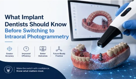 What Implant Dentists Should Know Before Switching to Intraoral Photogrammetry