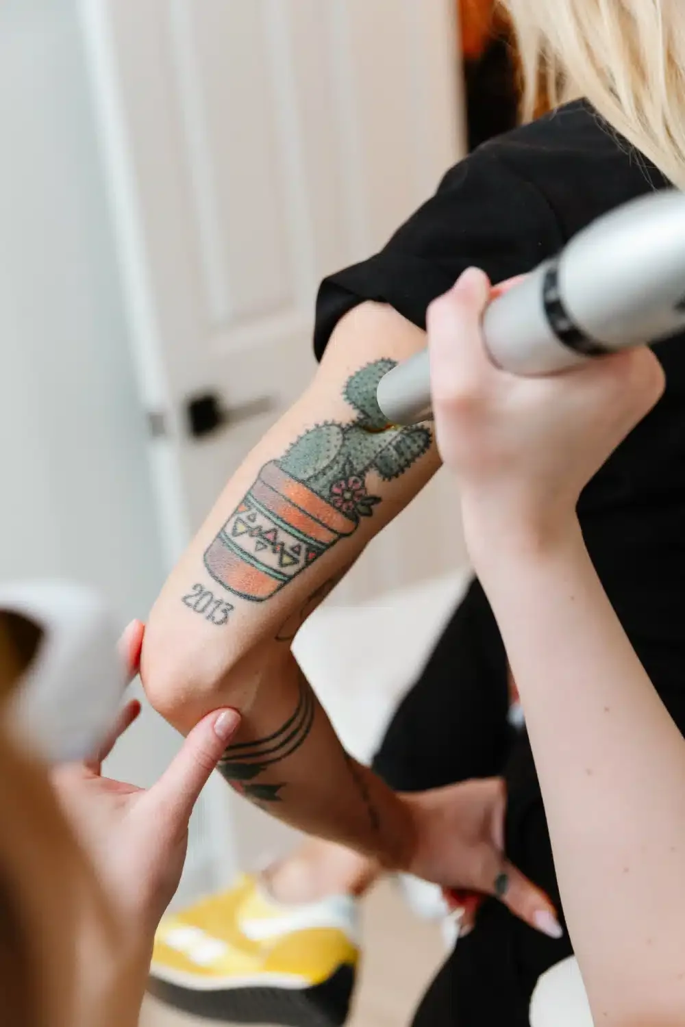 Ready to Move On From Your Tattoo? A Guide to Removal