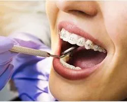 Finding the Top Dentist in Lahore: What to Look For