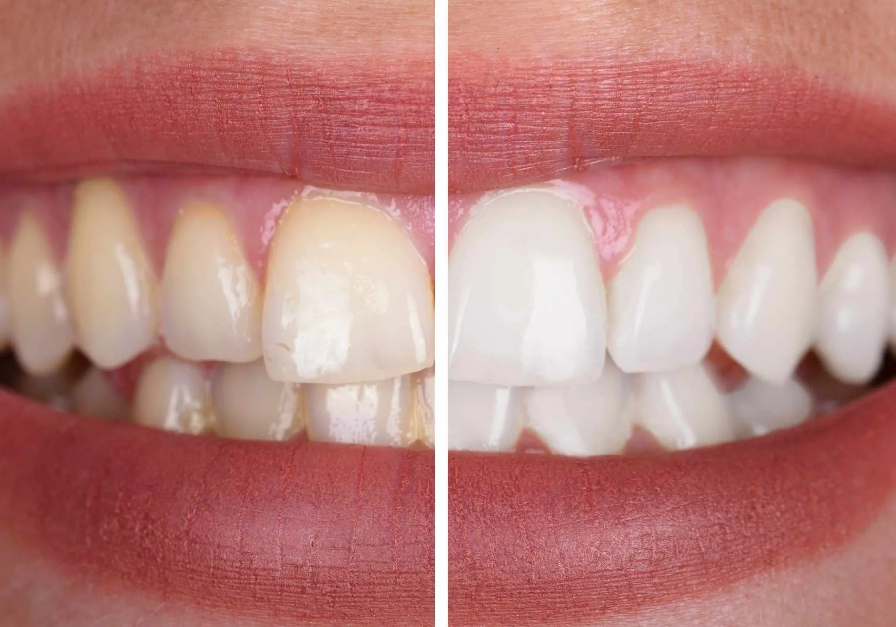Dental clinic in Lahore: When You Need a Dental Surgeon and What to Expect