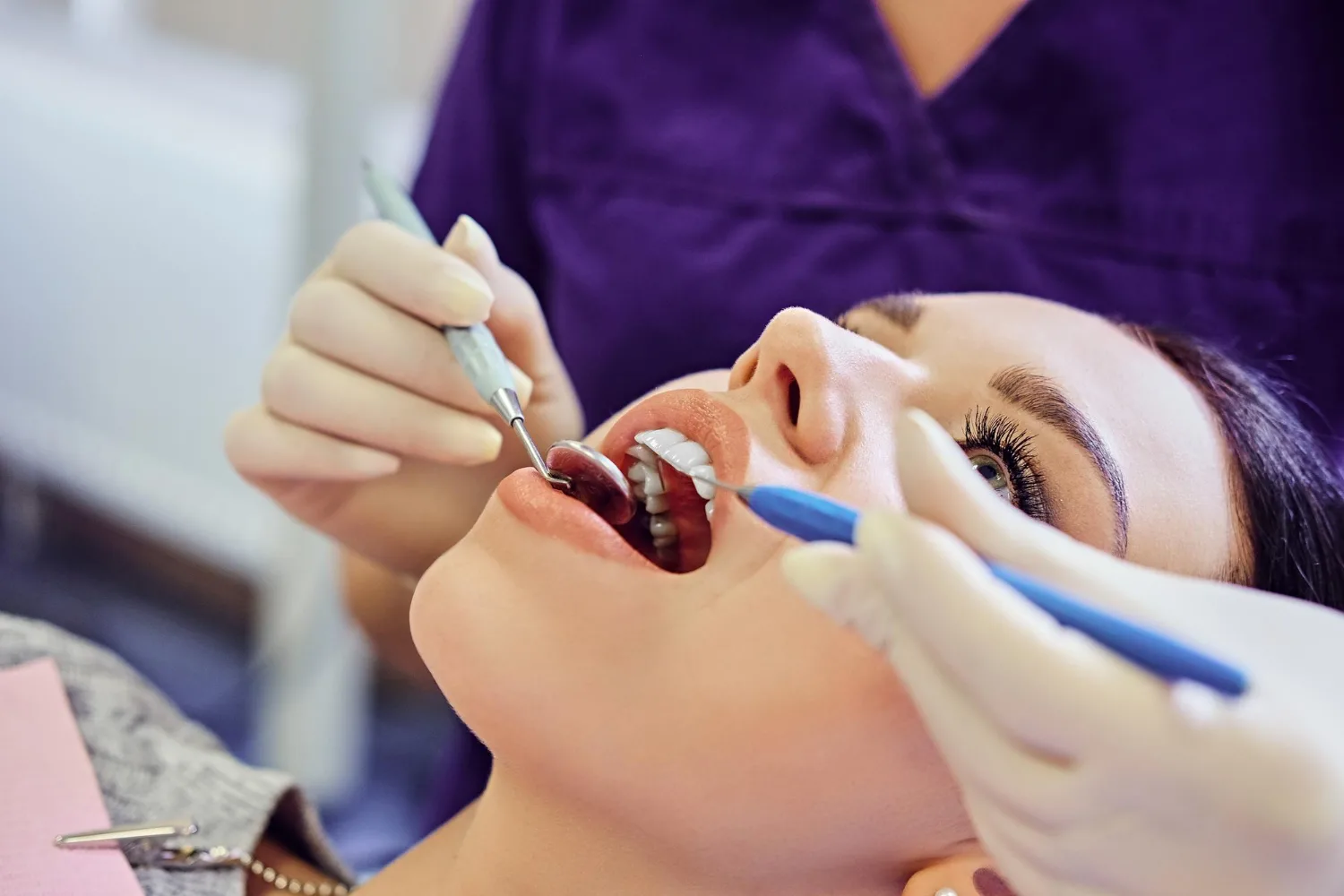 Teeth Whitening Treatment in RR Nagar Bangalore: Procedure, Benefits & Aftercare
