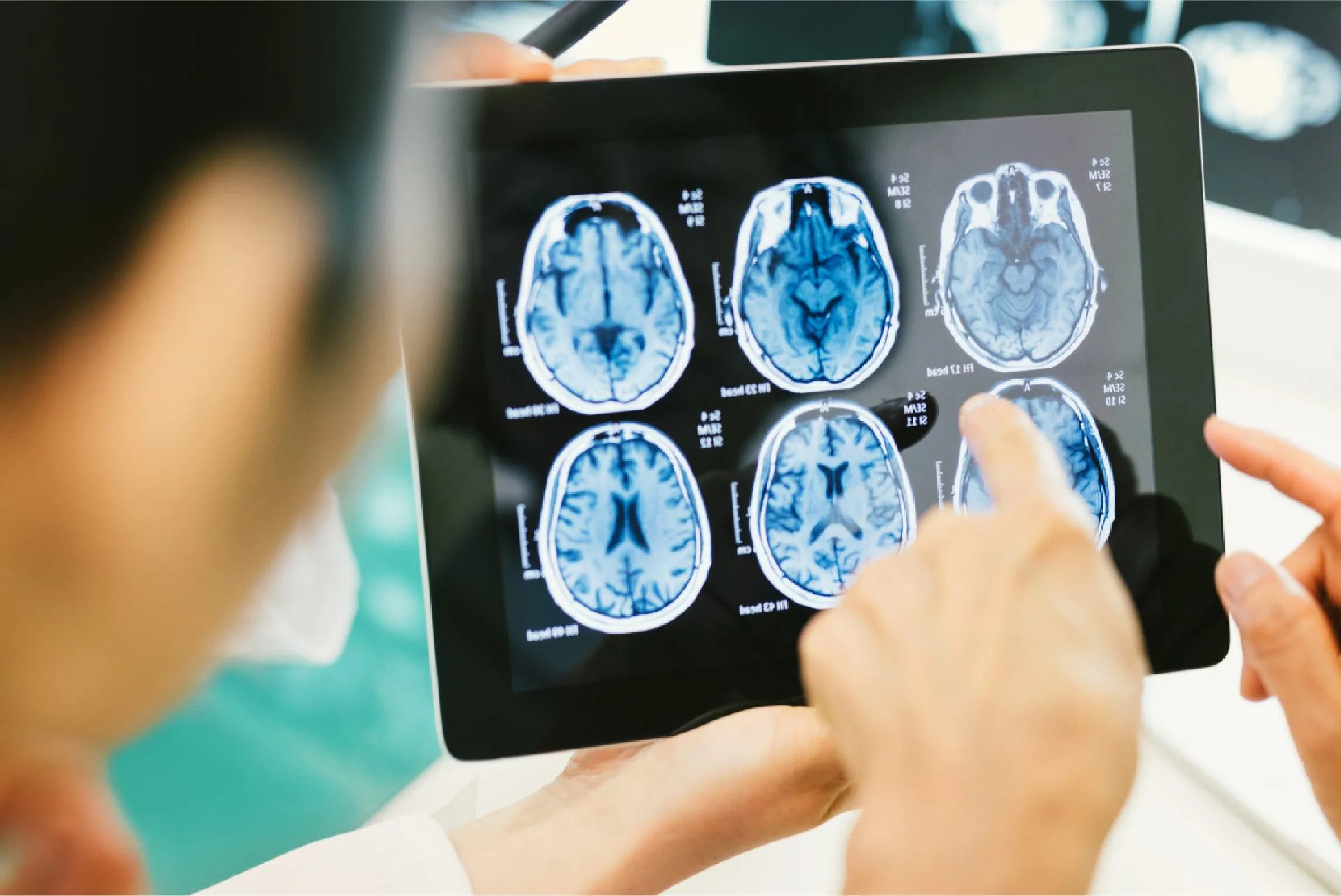 Diagnostic Centre in Lucknow for Convenient and Comprehensive Health Testing