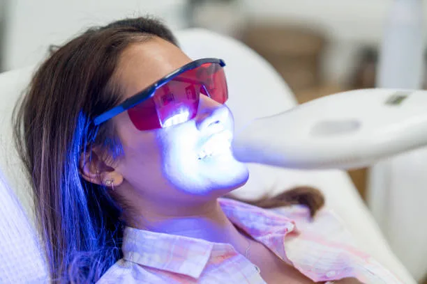 The Science of Radiant Smiles: Modern Enamel Chemistry and Professional Teeth Whitening