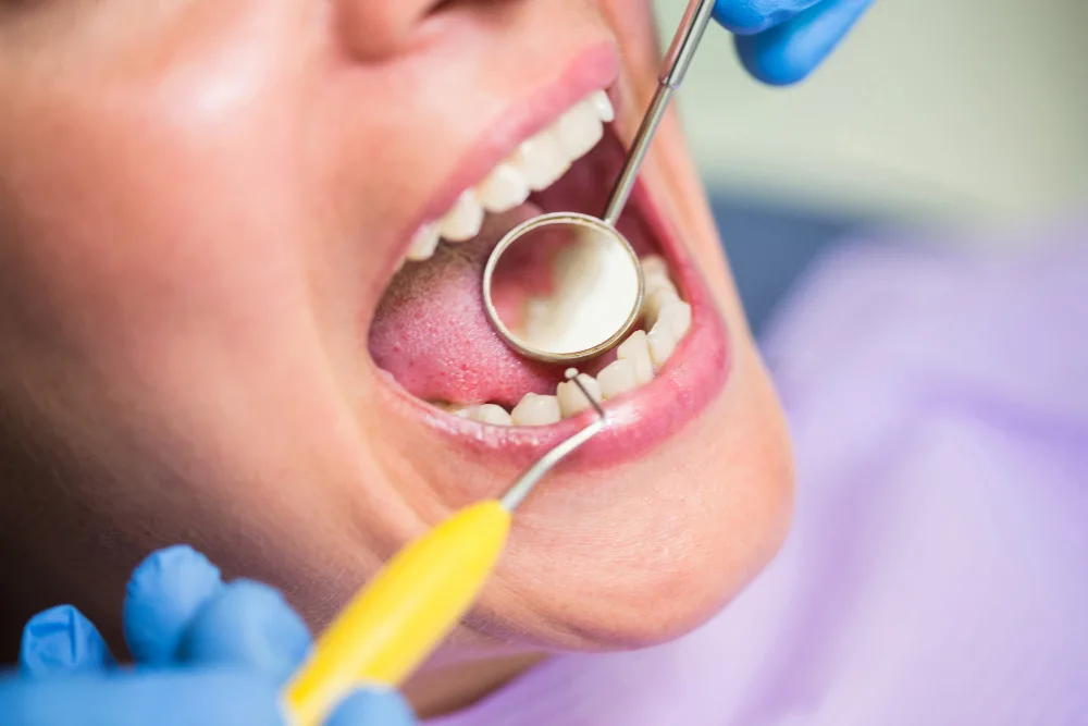 Painless Root Canal Treatment in Hyderabad: Myths vs Facts