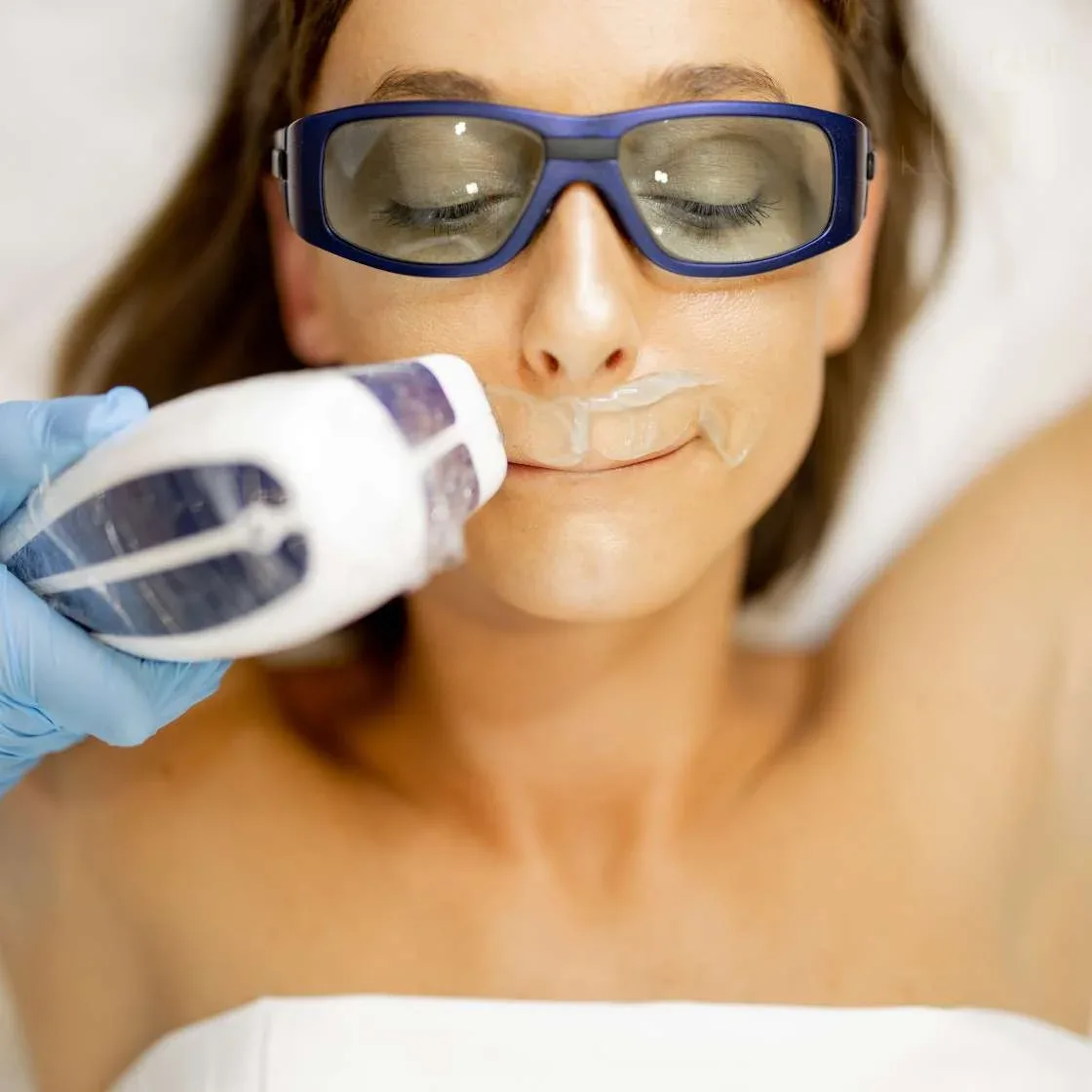 Smooth Skin Revolution: Why Laser Hair Removal Treatment in Lajpat Nagar is Trending in 2026