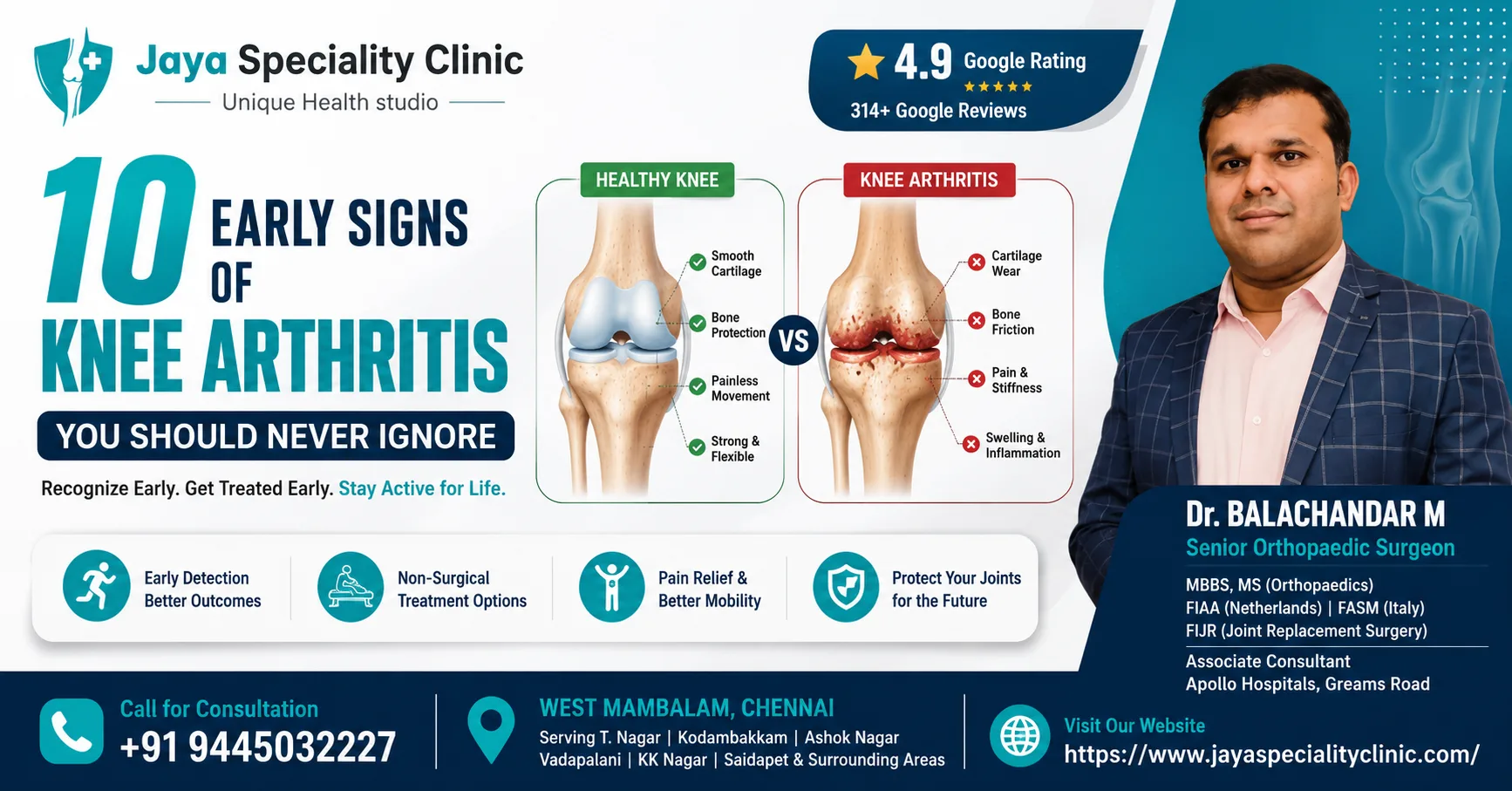 10 Early Signs of Knee Arthritis You Should Never Ignore