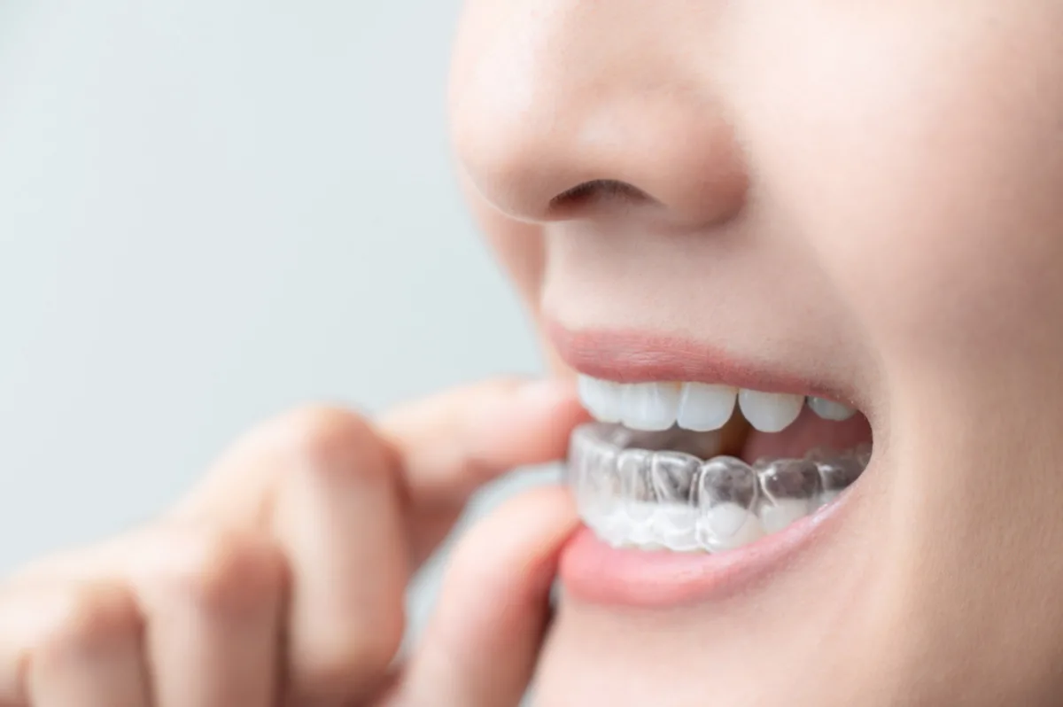 Invisalign vs Braces: Which Option Is Better for Adults?