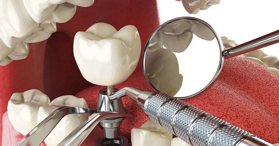 Advanced Dental Oral Surgery for Better Smile and Oral Health