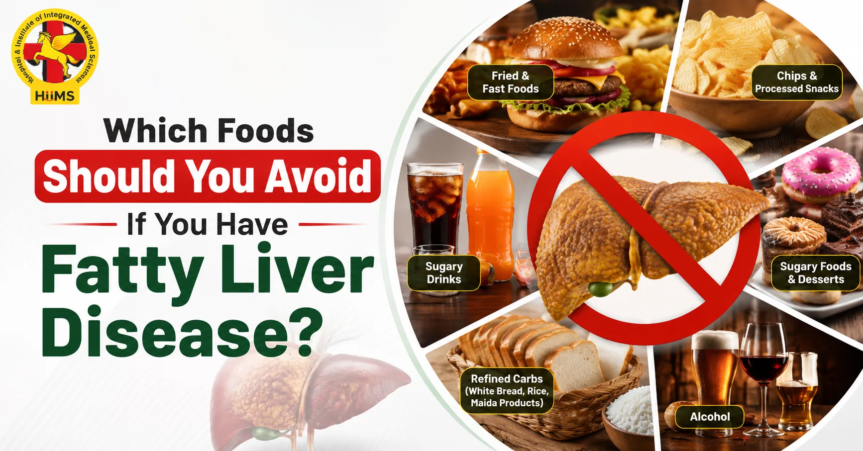 Which Foods Should You Avoid If You Have Fatty Liver Disease?