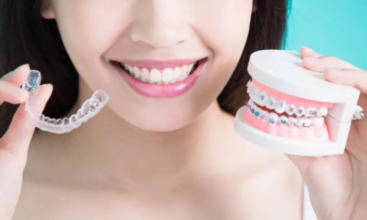 Wisdom Tooth Extraction in Dubai: Complete Guide to Removal and Recovery