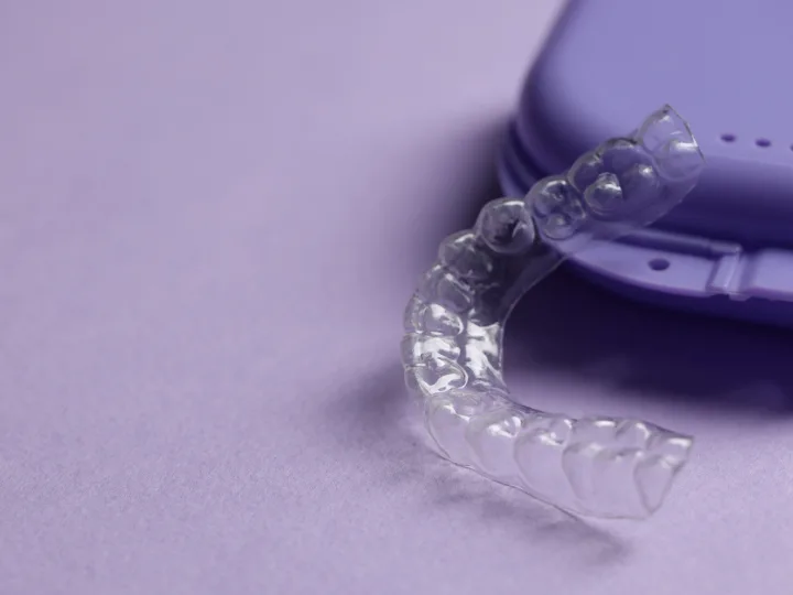 Retainers Cost Guide After Braces in Australia