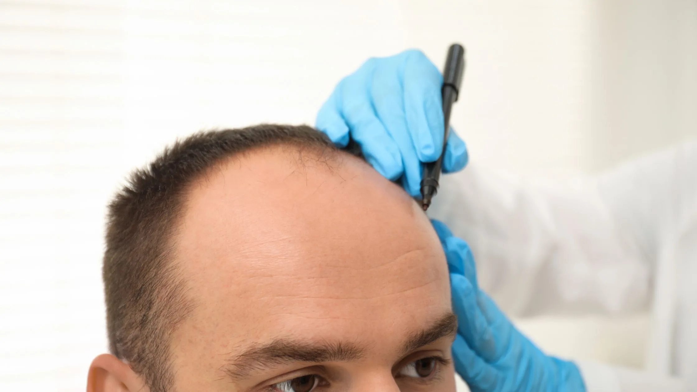 Is Hair Transplant in Navi Mumbai the Right Choice for Natural Hair Restoration in 2026?
