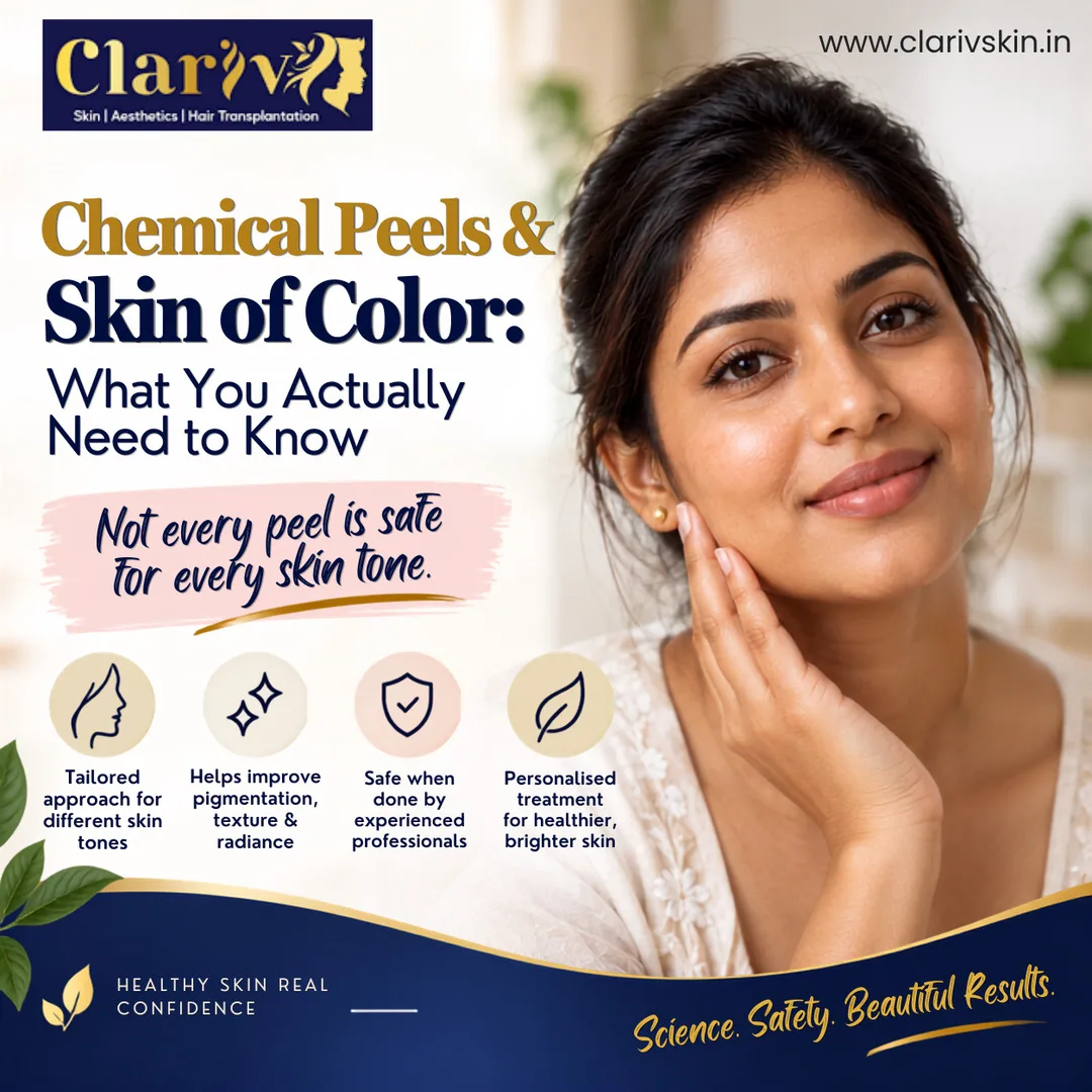 Chemical Peels and Skin of Color: What You Need to Know | Clarivskin.in
