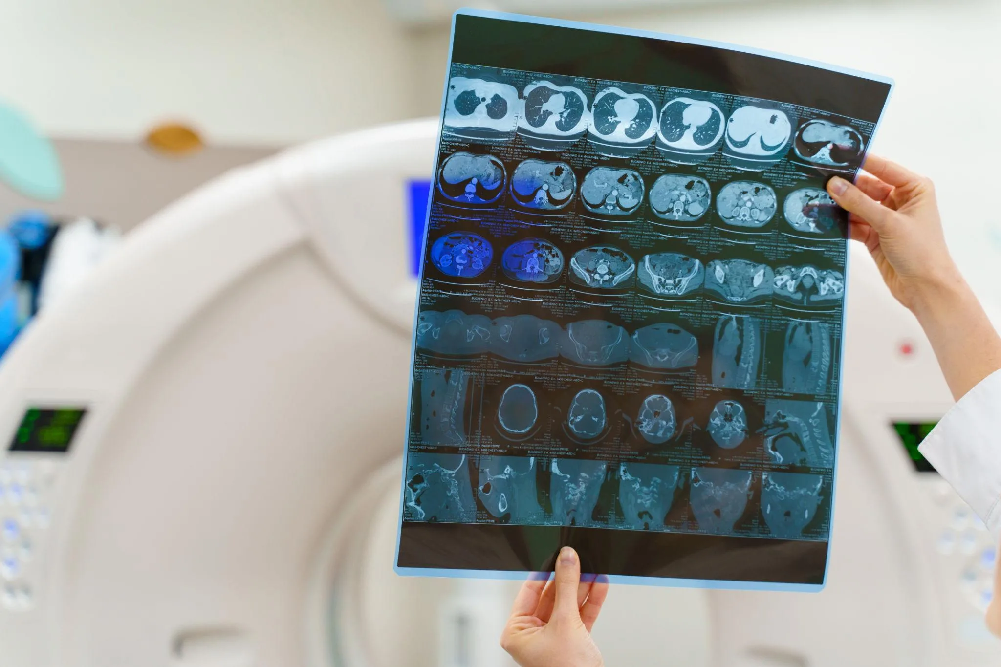 How Traumatic Brain Injury Animation Simplifies Complex Medical Evidence