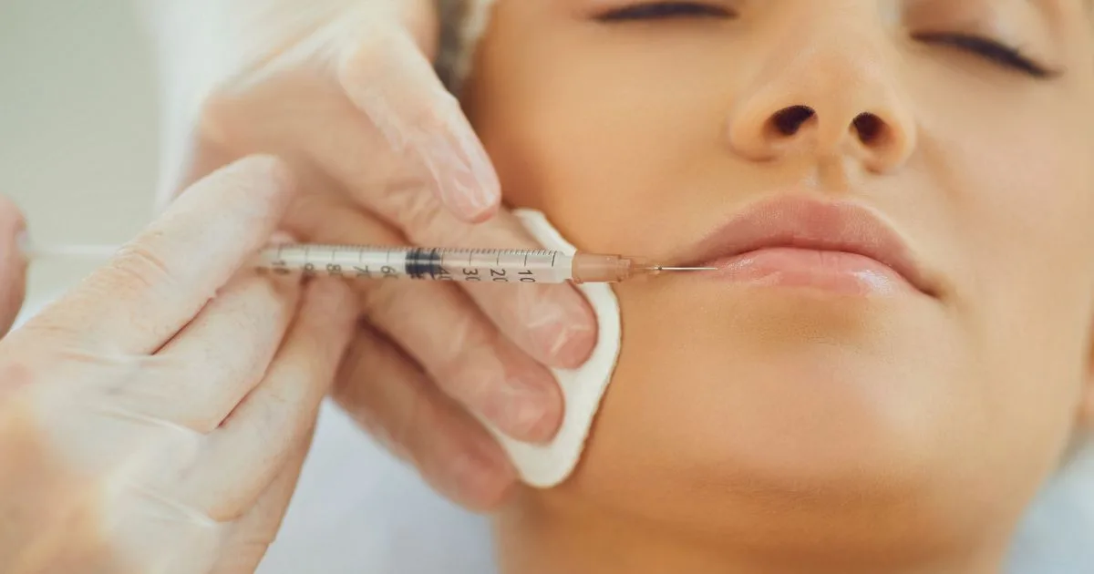 9 Luxury Reasons Lip Filler Remains a Top Beauty Choice Today