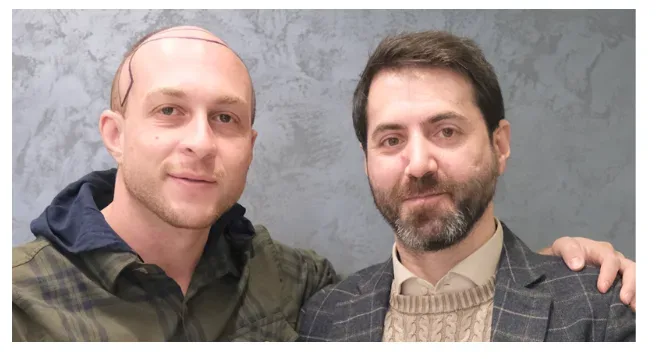 From Istanbul to the World: Hazem Altal’s Mission to Build Trust in Hair Restoration