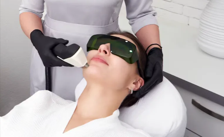 Face Hair Removal Laser Treatment Cost in India: A Complete Guide for 2026