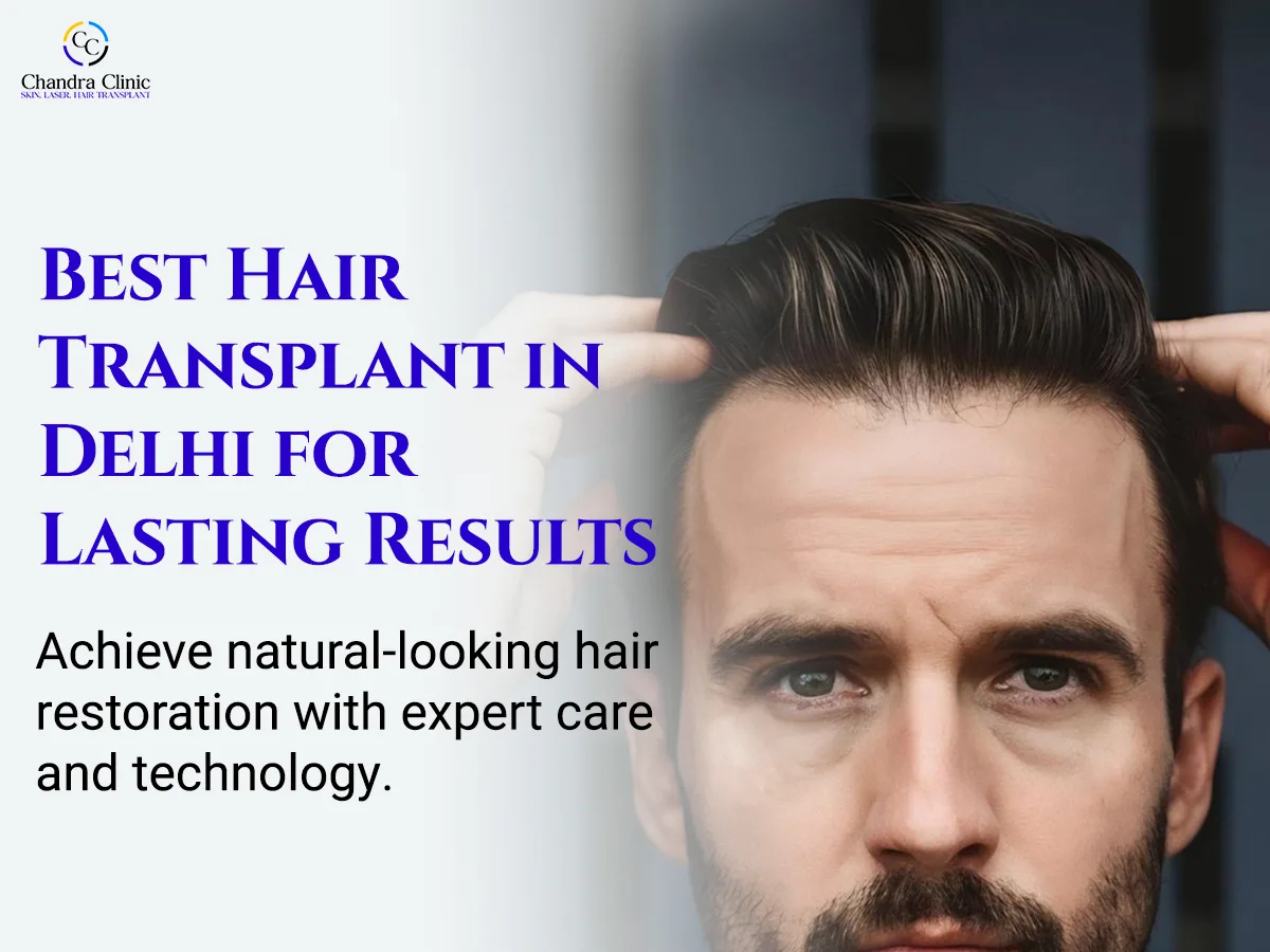 Hair Fall Getting Worse? Here's What Most Delhi Patients Don't Know