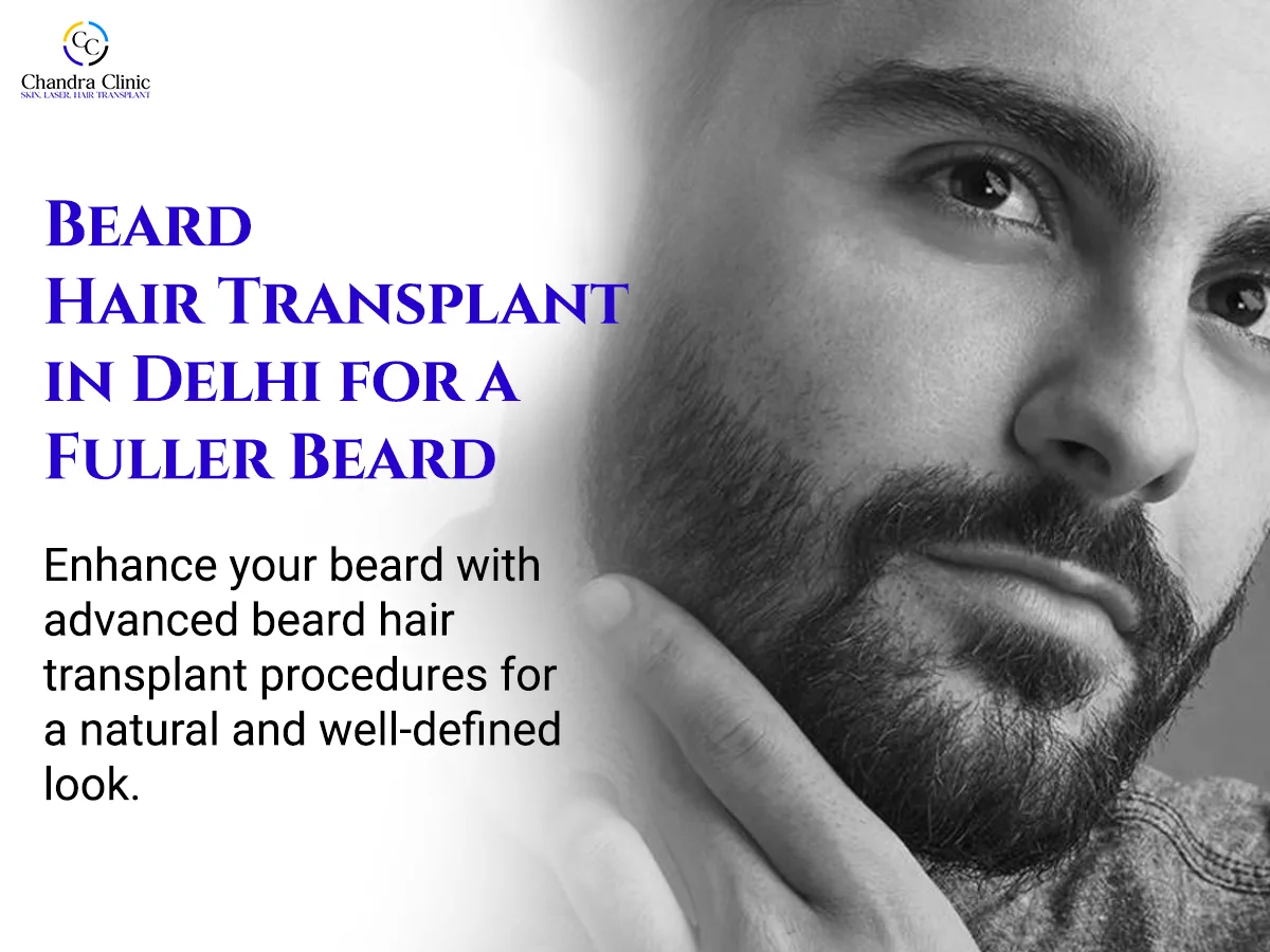 Beard Hair Transplant Delhi: What Every Man in India Should Know Before Deciding