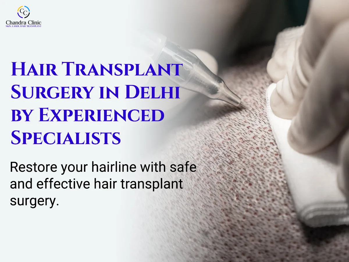 Why More People in Delhi Are Choosing Hair Transplant to Get Their Confidence Back