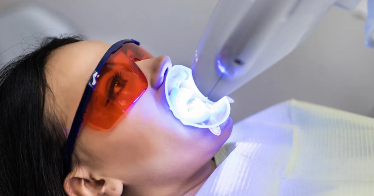 Teeth Whitening at Home: Smart, Safe Ways to Brighten Your Smile in Lahore