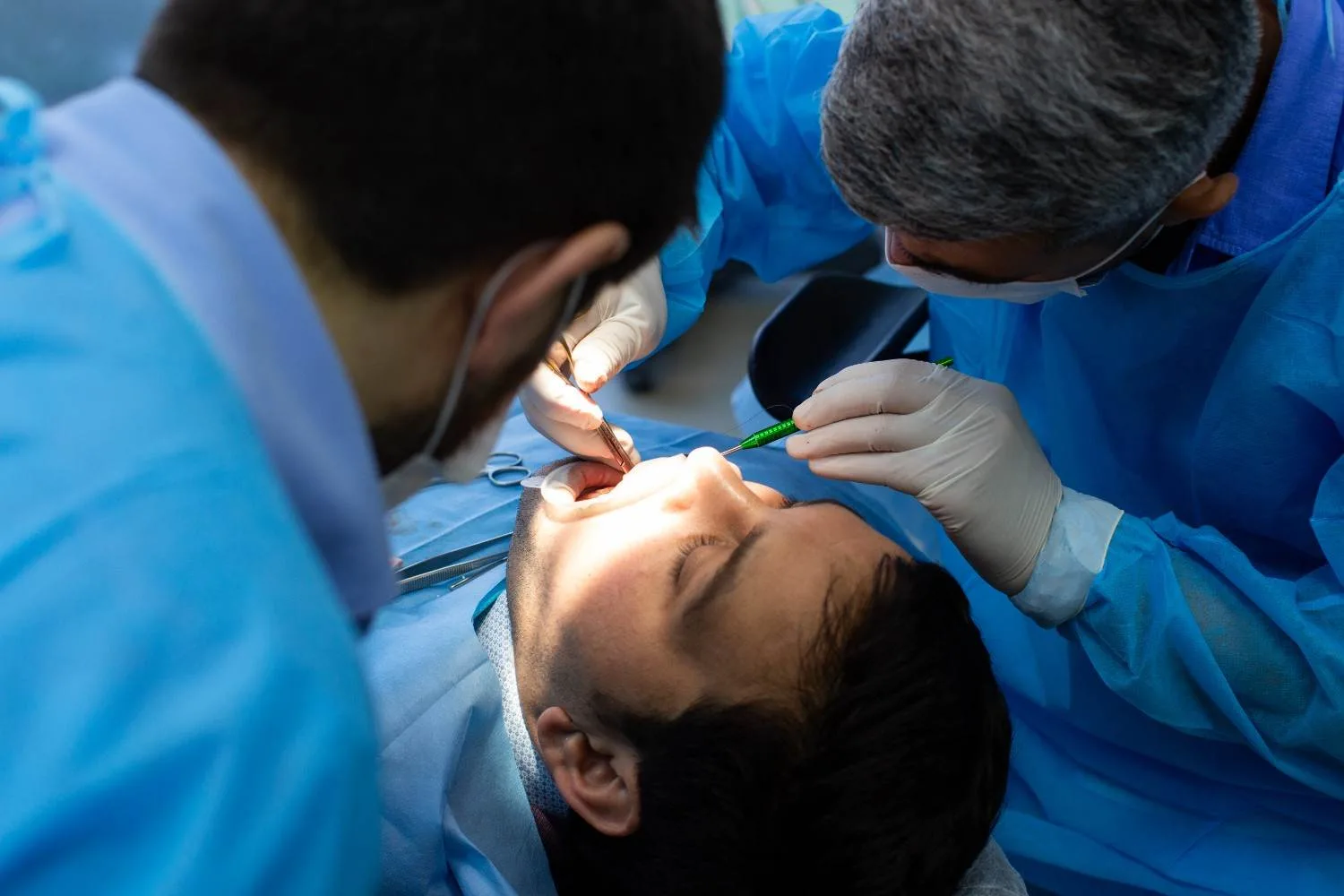 What Shapes the Price of a Root Canal? Three Questions to Ask Before You Book