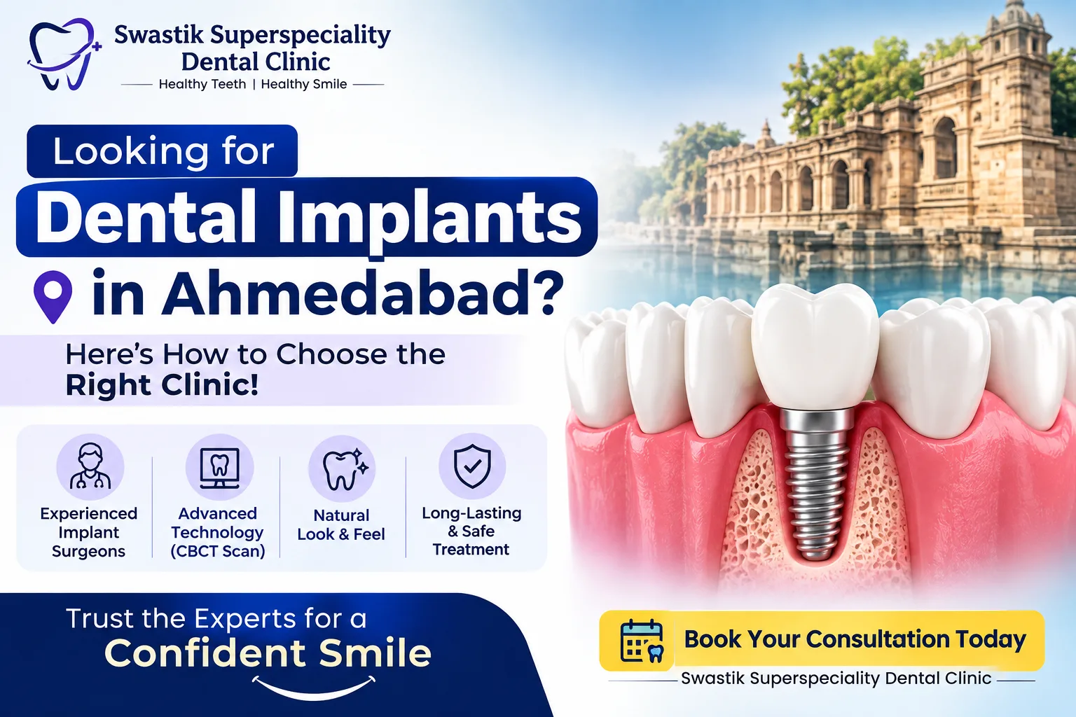 Looking for Dental Implants in Ahmedabad? Here’s How to Choose the Right Clinic!