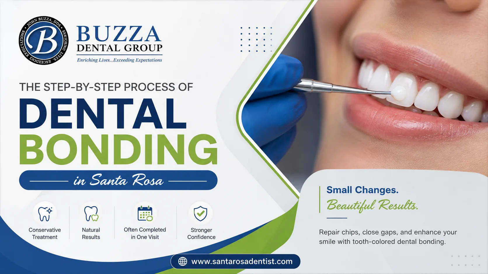 The Step-by-Step Process of Dental Bonding in Santa Rosa