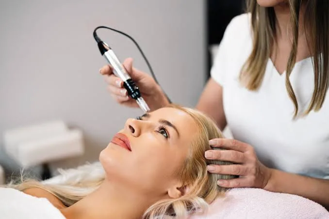 Microneedling: A Modern Approach to Smoother, Healthier-Looking Skin