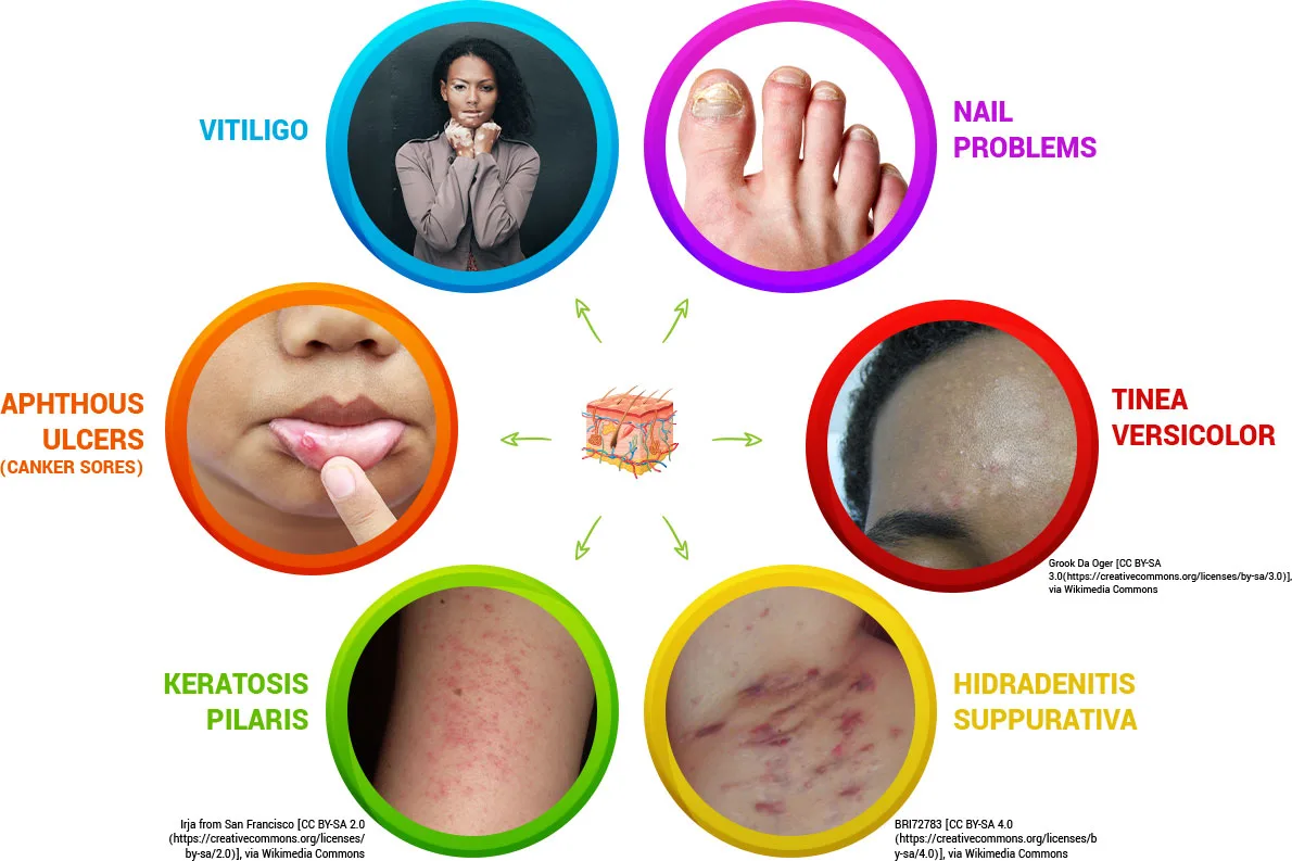How to Find a Skin Rash Doctor Near You in Los Angeles