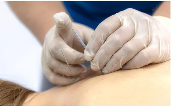 When Should an Athlete Consider Acupuncture for Muscle Pain and Dysfunction?