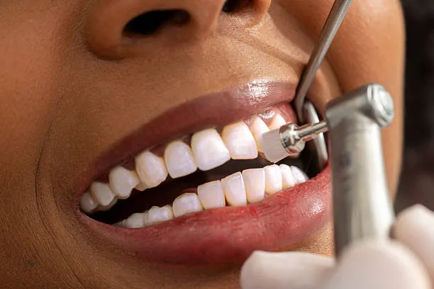What Should You Look for When Choosing a Dentist in Your Area?