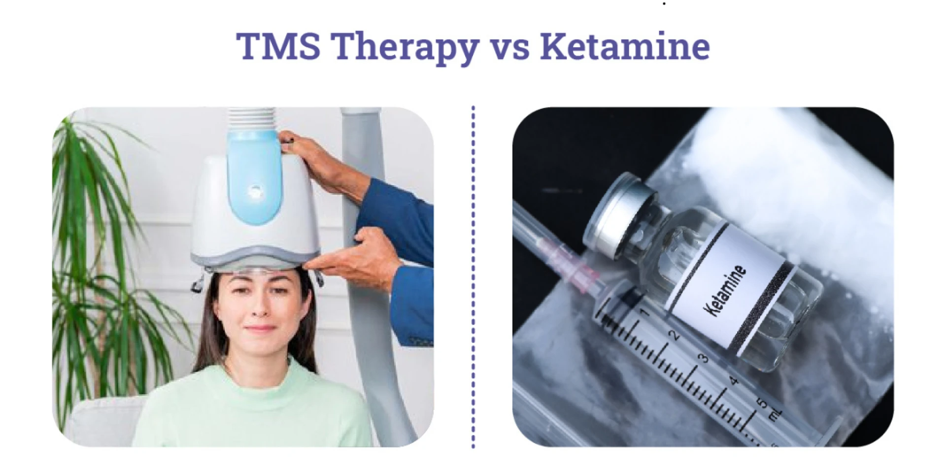 Ketamine vs. TMS: Understanding the Best Treatment for You