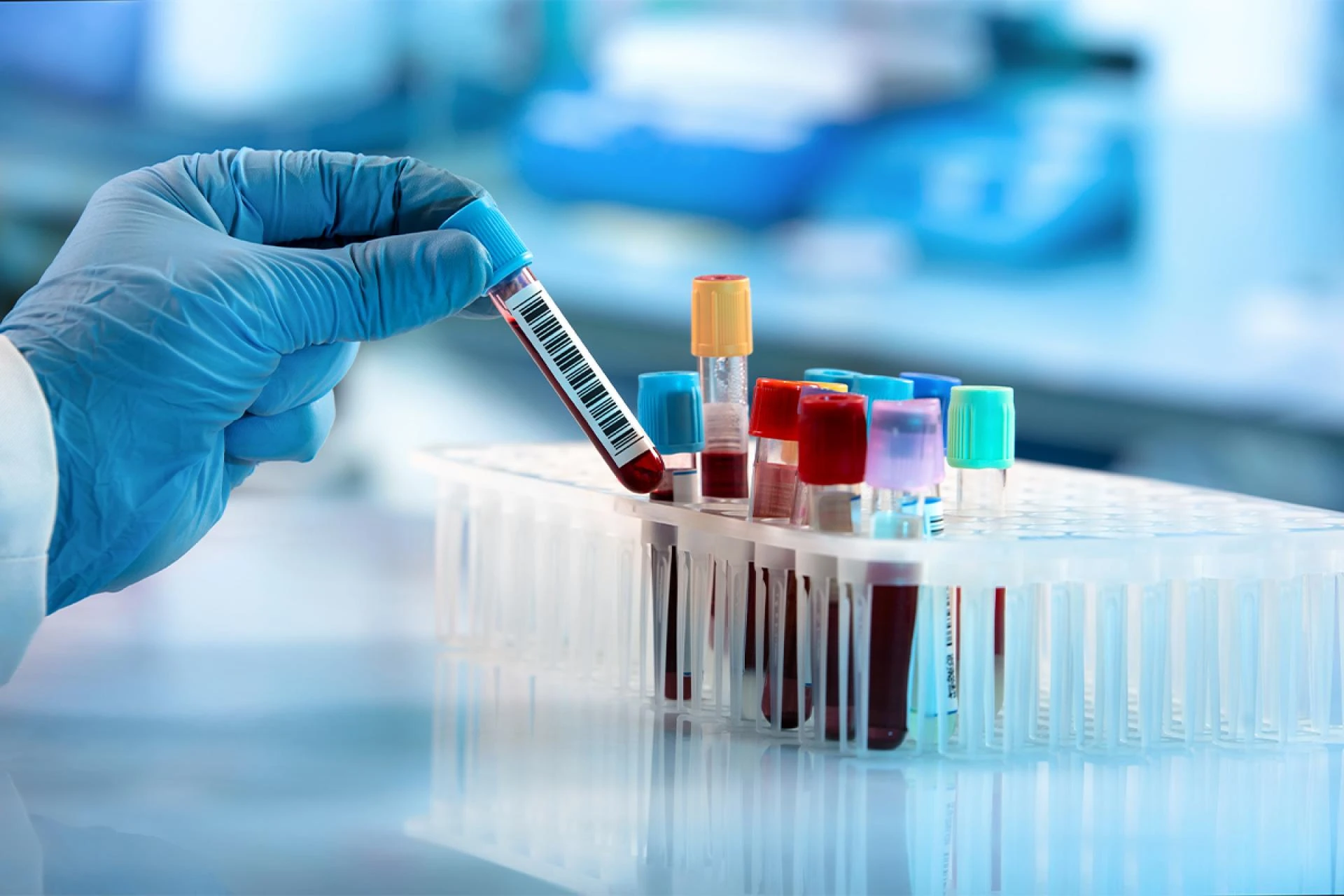 Comprehensive Guide to Blood Tests: Everything You Need to Know for Optimal Health
