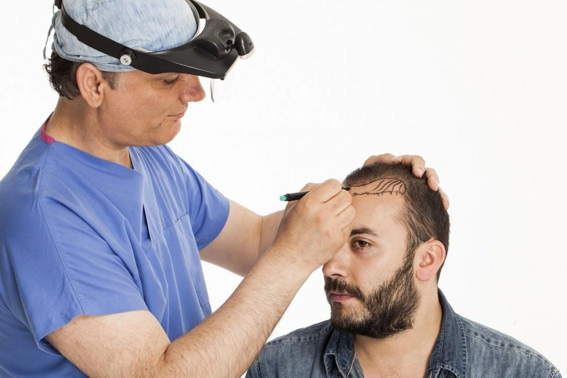 Side Effects of Hair Transplant in Islamabad and How to Manage Them