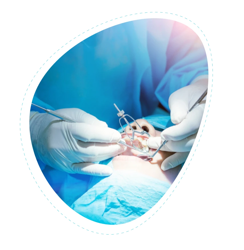 How Many Different Types of Oral Surgery Are There?