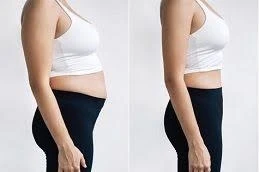 What to Expect When Starting Mounjaro Treatment in Dubai